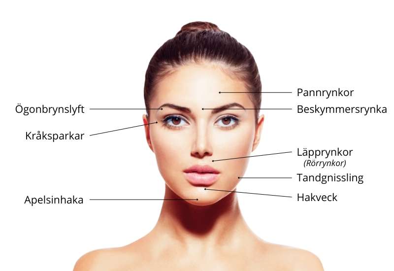 IDANA Beauty - Botoxbehandlingar